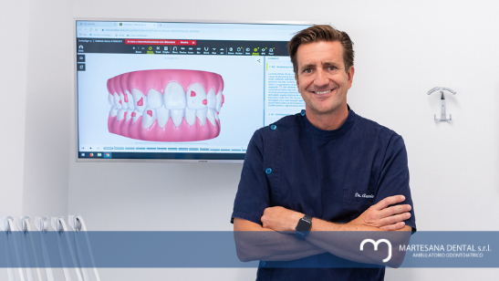 A cosa serve l’implantologia dentale?